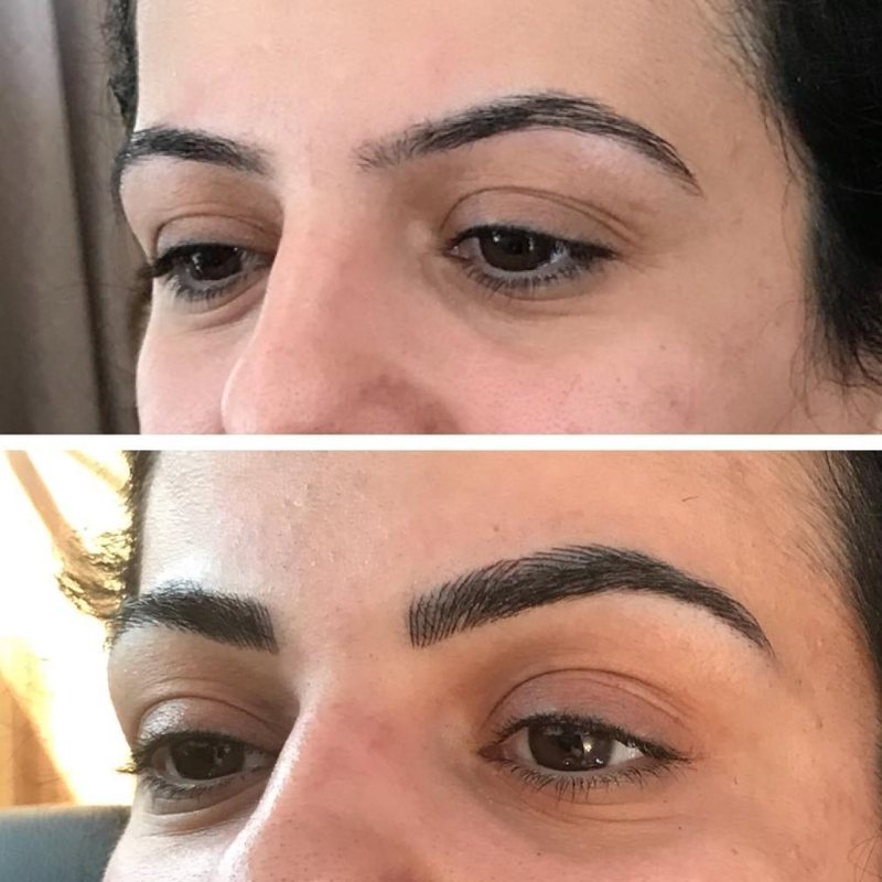Before and after brow transformation