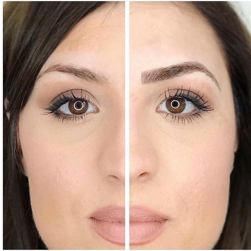 Before and after brows, split view