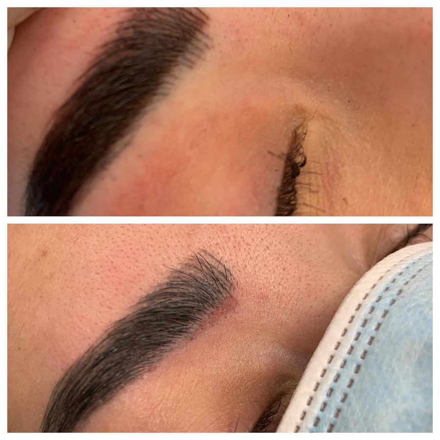 Permanent makeup removal, one session