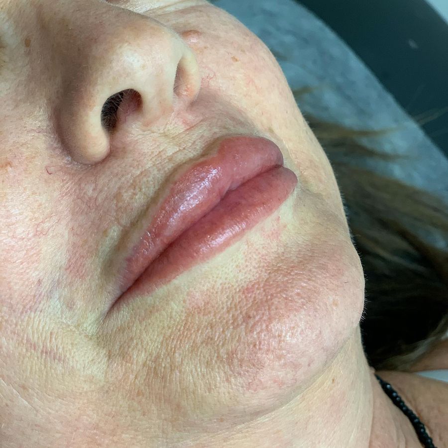 Before and after lip blush